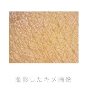 【パーソナルスキンチェック】 ④キメのはなし。